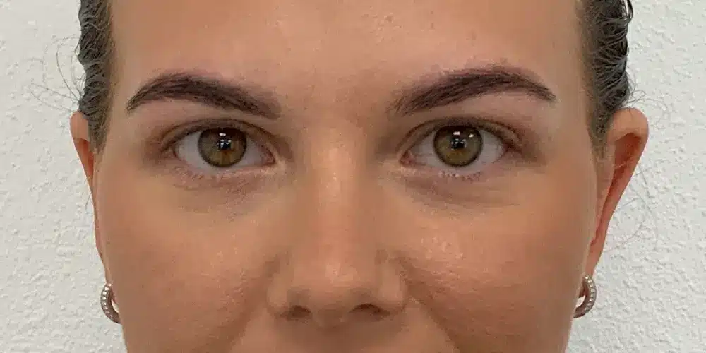 Looks Clinics eindresultaat