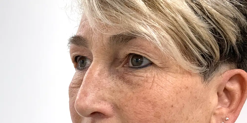 Looks Clinics oorspronkelijke toestand