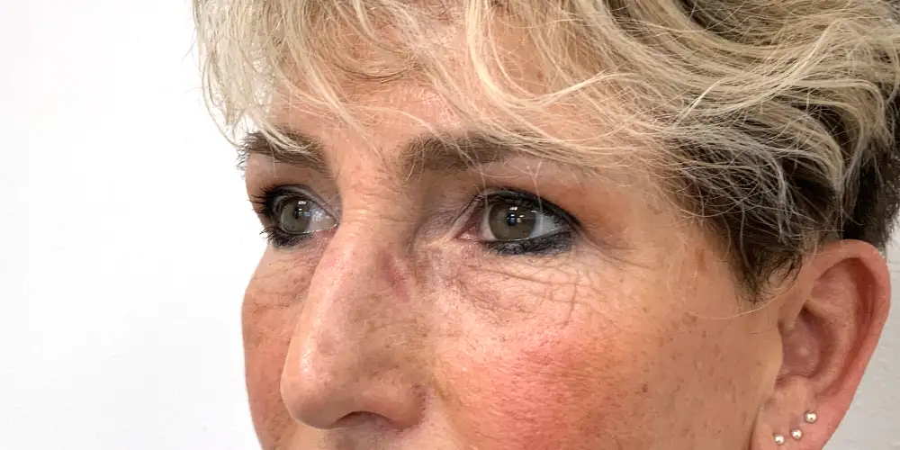 Looks Clinics outcome behandeling