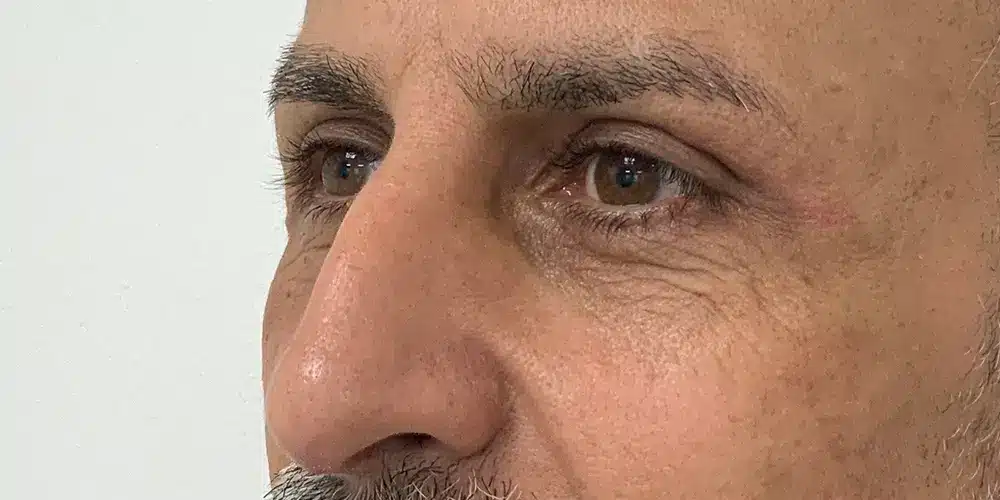 Looks Clinics post procedure