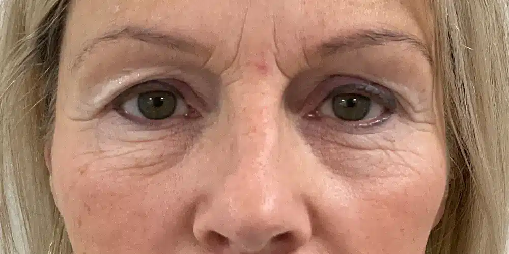 Looks Clinics pre procedure