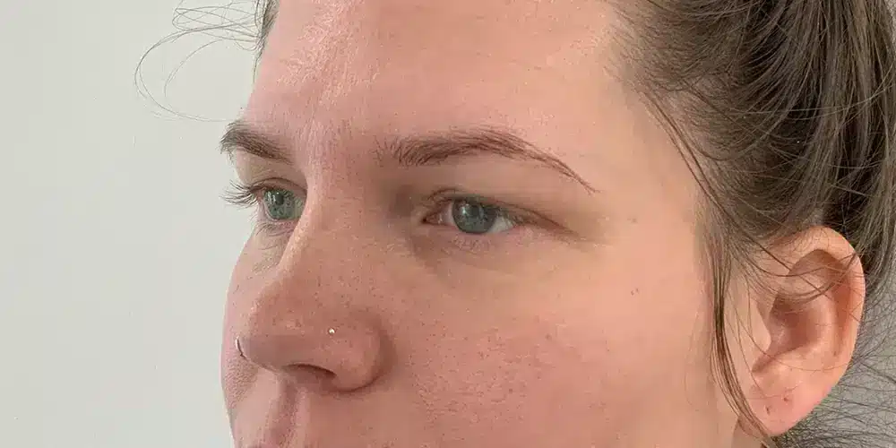 Looks Clinics scan voor de behandeling