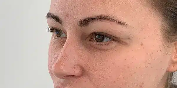Looks Clinics status voor de behandeling