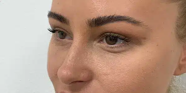 Looks Clinics verandering na de behandeling